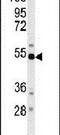 Beta-Secretase 1 antibody, PA5-14878, Invitrogen Antibodies, Western Blot image 