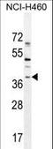 SRY-Box 1 antibody, LS-C203701, Lifespan Biosciences, Western Blot image 