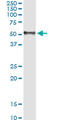 Hepatitis A Virus Cellular Receptor 1 antibody, LS-C139216, Lifespan Biosciences, Immunoprecipitation image 