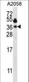 Vesicle Associated Membrane Protein 7 antibody, LS-C160499, Lifespan Biosciences, Western Blot image 