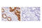 Integrin Subunit Beta 4 antibody, 14803T, Cell Signaling Technology, Immunohistochemistry paraffin image 