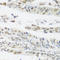 Snail Family Transcriptional Repressor 1 antibody, STJ29909, St John