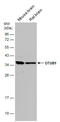 OTU Deubiquitinase, Ubiquitin Aldehyde Binding 1 antibody, GTX133353, GeneTex, Western Blot image 