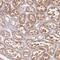 TPD52 Like 2 antibody, PA5-61532, Invitrogen Antibodies, Immunohistochemistry frozen image 