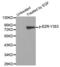 Ezrin antibody, abx000397, Abbexa, Western Blot image 