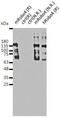 Roundabout Guidance Receptor 4 antibody, GTX54660, GeneTex, Western Blot image 