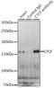 CCCTC-Binding Factor antibody, GTX65926, GeneTex, Immunoprecipitation image 