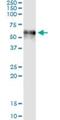 Coagulation Factor IX antibody, H00002158-M01, Novus Biologicals, Immunoprecipitation image 