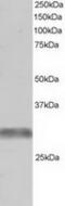Tripartite Motif Containing 7 antibody, TA302866, Origene, Western Blot image 