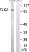 Tousled Like Kinase 2 antibody, PA5-39444, Invitrogen Antibodies, Western Blot image 