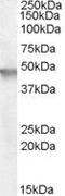 Cytohesin 2 antibody, PA5-18833, Invitrogen Antibodies, Western Blot image 