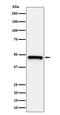 Inhibitor Of Growth Family Member 1 antibody, M02999, Boster Biological Technology, Western Blot image 