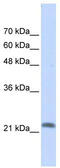 RAS Like Family 10 Member A antibody, TA340116, Origene, Western Blot image 