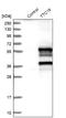 Tetratricopeptide repeat protein 19 antibody, NBP1-93979, Novus Biologicals, Western Blot image 