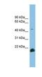 Transforming Growth Factor Beta 2 antibody, NBP1-59437, Novus Biologicals, Western Blot image 