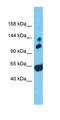 Ral GTPase Activating Protein Catalytic Alpha Subunit 1 antibody, orb327096, Biorbyt, Western Blot image 