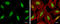 Cyclin Dependent Kinase 9 antibody, GTX107758, GeneTex, Immunocytochemistry image 