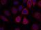 Ribosomal Protein S6 antibody, A01567, Boster Biological Technology, Immunohistochemistry frozen image 