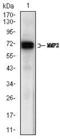 Matrix Metallopeptidase 2 antibody, GTX60669, GeneTex, Western Blot image 