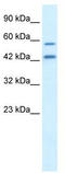 Autophagy Related 4B Cysteine Peptidase antibody, TA335641, Origene, Western Blot image 
