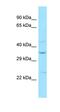 Sphingosine-1-Phosphate Receptor 2 antibody, orb331298, Biorbyt, Western Blot image 