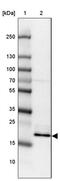 GAR1 Ribonucleoprotein antibody, PA5-63656, Invitrogen Antibodies, Western Blot image 