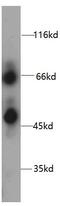 HPSE1 antibody, FNab04003, FineTest, Western Blot image 
