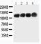 Carcinoembryonic Antigen Related Cell Adhesion Molecule 1 antibody, MA1023, Boster Biological Technology, Western Blot image 