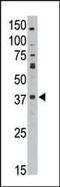 MAGE Family Member A10 antibody, PA5-13147, Invitrogen Antibodies, Western Blot image 