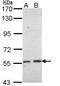 Cytochrome P450 Family 17 Subfamily A Member 1 antibody, PA5-29798, Invitrogen Antibodies, Western Blot image 
