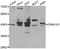 Casein Kinase 1 Gamma 1 antibody, STJ29646, St John