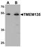 Transmembrane Protein 135 antibody, A14036, Boster Biological Technology, Western Blot image 