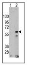 Serine/threonine-protein kinase PINK1, mitochondrial antibody, AM11055PU-N, Origene, Western Blot image 