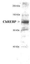 MLX Interacting Protein Like antibody, PA5-22921, Invitrogen Antibodies, Western Blot image 