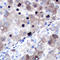 DNA Topoisomerase II Alpha antibody, LS-B16084, Lifespan Biosciences, Immunohistochemistry frozen image 