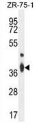 Transmembrane BAX Inhibitor Motif Containing 4 antibody, AP54281PU-N, Origene, Western Blot image 