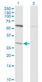 Thiopurine S-Methyltransferase antibody, LS-C133493, Lifespan Biosciences, Western Blot image 