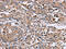 MAGE Family Member A3 antibody, CSB-PA146268, Cusabio, Immunohistochemistry frozen image 