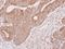 Leucine Rich Repeat Containing 1 antibody, NBP2-19332, Novus Biologicals, Immunohistochemistry paraffin image 