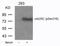 Cell Division Cycle 25C antibody, NB100-81841, Novus Biologicals, Western Blot image 
