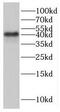 Isovaleryl-CoA dehydrogenase, mitochondrial antibody, FNab04426, FineTest, Western Blot image 