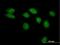 LRAT Domain Containing 2 antibody, H00286053-B01P, Novus Biologicals, Immunocytochemistry image 