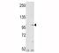 Fibroblast Growth Factor Receptor 1 antibody, F48397-0.4ML, NSJ Bioreagents, Western Blot image 