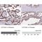 Cytochrome P450 19A1 antibody, NBP2-48998, Novus Biologicals, Immunohistochemistry paraffin image 