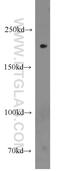 Cullin 7 antibody, 13738-1-AP, Proteintech Group, Western Blot image 