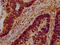 HECT And RLD Domain Containing E3 Ubiquitin Protein Ligase 5 antibody, LS-C680586, Lifespan Biosciences, Immunohistochemistry paraffin image 