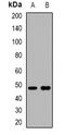 Bone Morphogenetic Protein 10 antibody, orb382634, Biorbyt, Western Blot image 