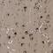 STARD3 N-Terminal Like antibody, NBP1-93527, Novus Biologicals, Immunohistochemistry paraffin image 