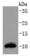 Dynein Light Chain LC8-Type 1 antibody, NBP2-67796, Novus Biologicals, Western Blot image 