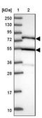 Adaptor Protein, Phosphotyrosine Interacting With PH Domain And Leucine Zipper 2 antibody, NBP2-14304, Novus Biologicals, Western Blot image 